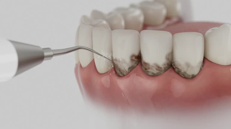 Reliable Emergency Dentist contractor in Lucas, TX by Smile Center Dentistry